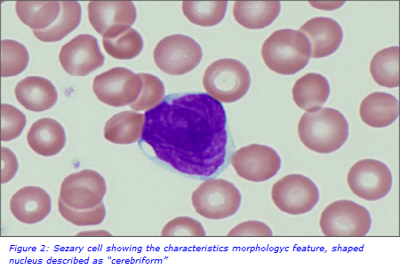 cerebriform nuclei